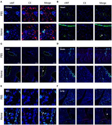 Heme Drives Susceptibility of Glomerular Endothelium to Complement Overactivation Due to Inefficient Upregulation of Heme Oxygenase-1